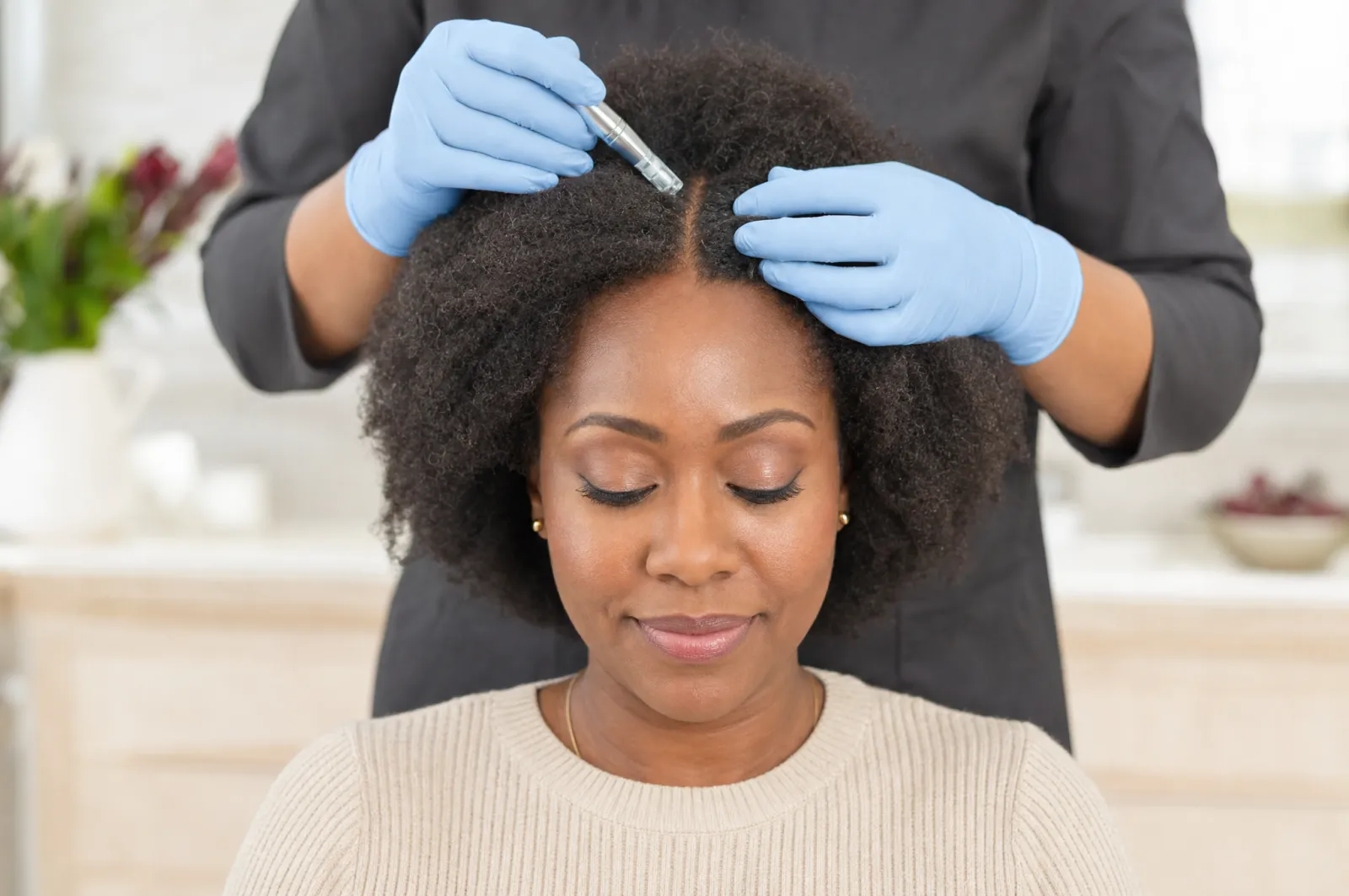 Scalp treatment for hair restoration by an aesthetic nurse injector.